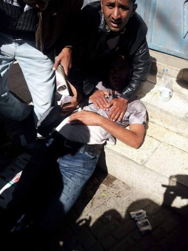 أحد الجرحى بعد الاعتداء عليه من قبل مليشيات الحوثي